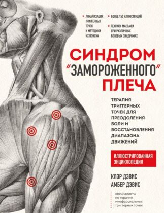 Синдром «замороженного» плеча. Терапия триггерных точек для преодоления боли и восстановления диапазона движений