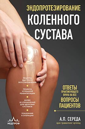 Эндопротезирование коленного сустава: ответы практикующего врача на все вопросы пациентов