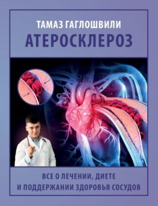 Атеросклероз. Все о лечении, диете и поддержании здоровья сосудов (мягк.обл.)